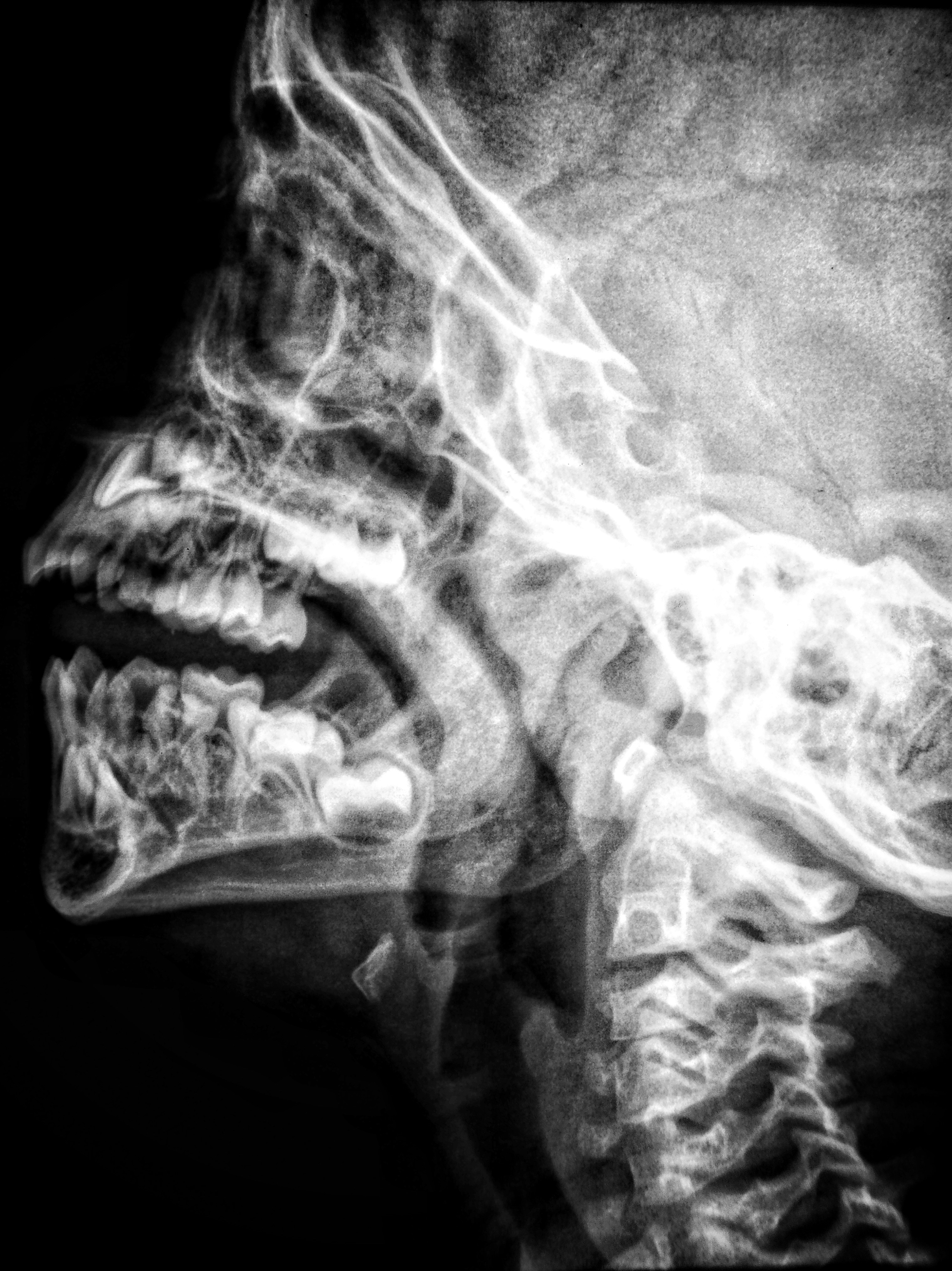 Jaw & Joint Disorders